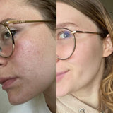 SkinGlow+ Pro - Luxvi